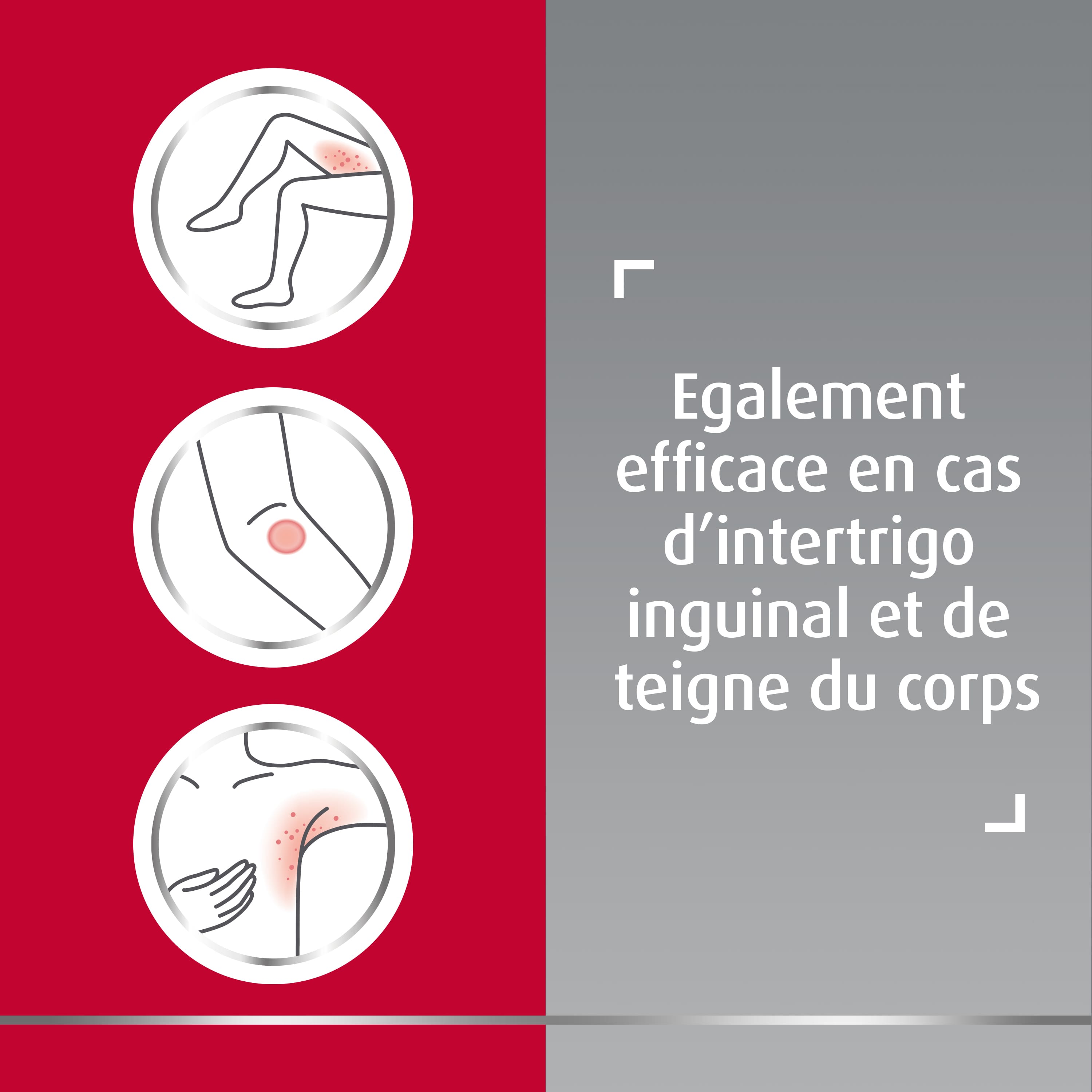  Trois icônes représentant des zones prurigineuses (intérieur des cuisses, coude et aisselle) avec texte à droite: Egalement efficace en cas d’intertrigo inguinal et de teigne du corps